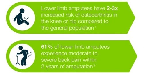 Lower Limb Amputee Stats