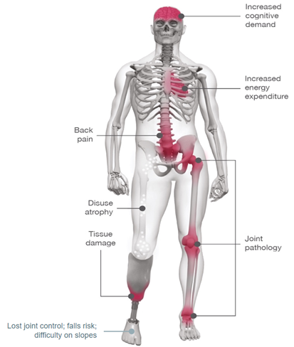 Skeletal and muscular pain from shifting weight
