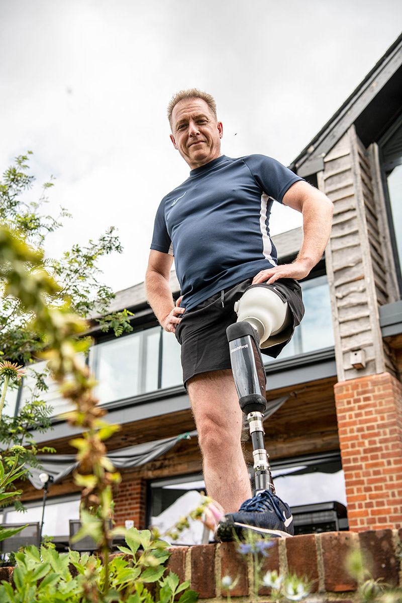 Ian's life has been transformed since he started wearing the Orion3 prosthetic knee
